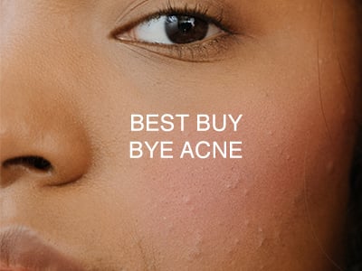 Best buy bye acne-1